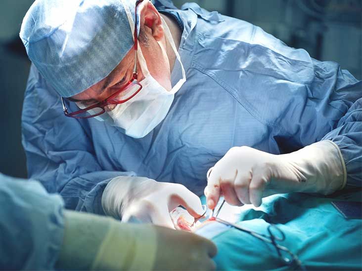 What Is a Strangulated Hernia?