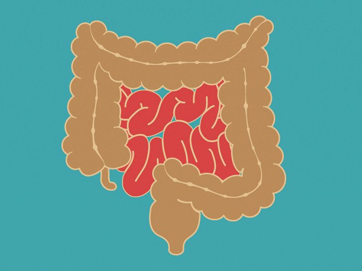 Small Intestine Cancer