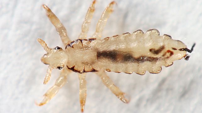 What Do Lice Look Like?