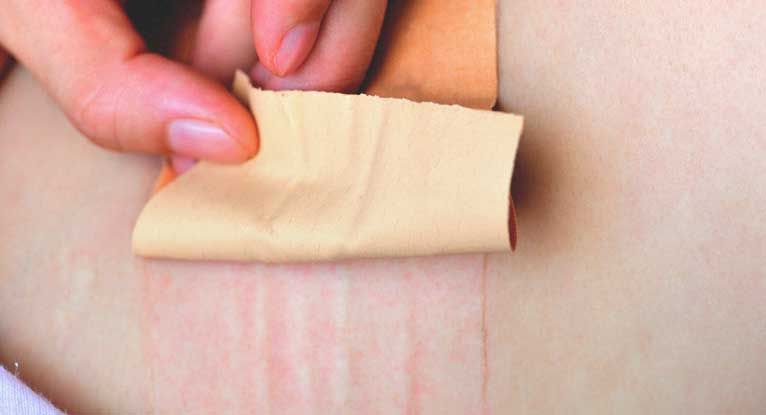 How to Apply a Transdermal Patch