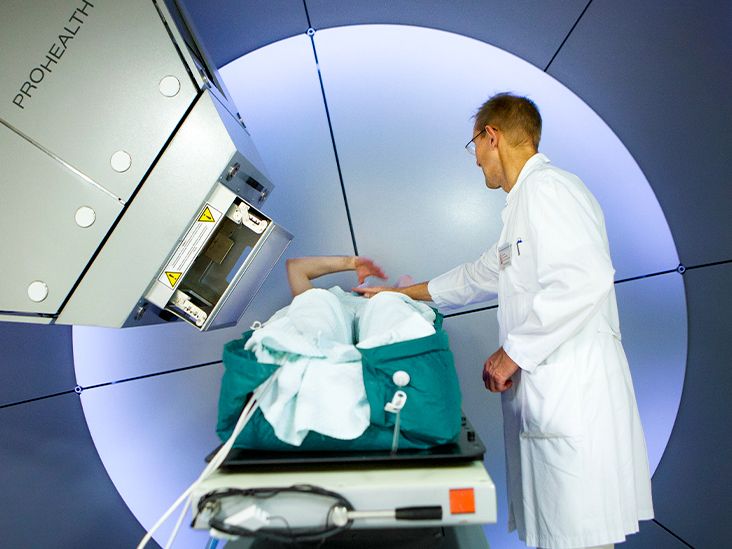 Proton Therapy for Breast Cancer