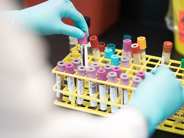 Can a Blood Test Diagnose Endometriosis?￼