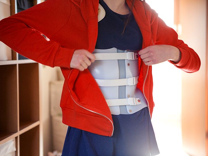 How Do You Treat Scoliosis Without Surgery?