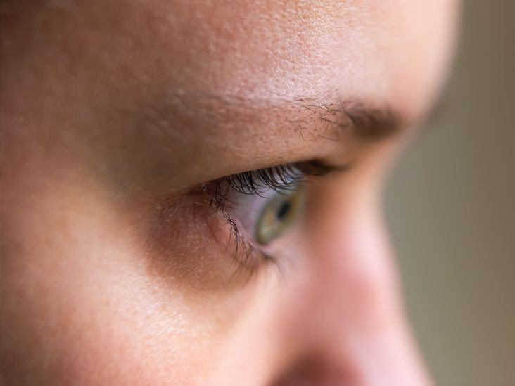 Bulging Eyes: Symptoms, Causes, and Treatment for Proptosis