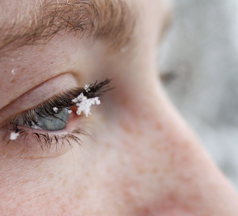 Ojos secos en el invierno: Causas, tratamiento y prevención