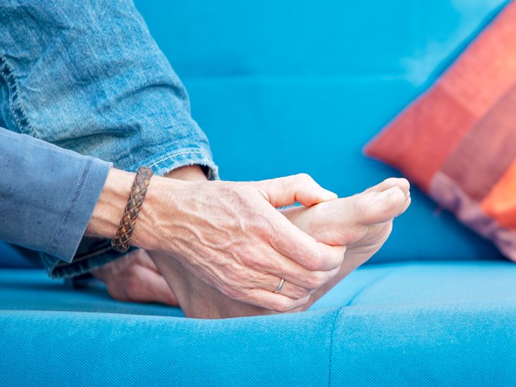 Gout: Symptoms, Causes, and Treatments